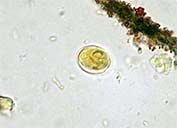 Giardia Cyst