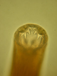 Hookworm Teeth