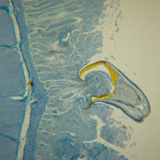 Hookworm attached to dog intestine
