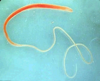 Adult Whipworm