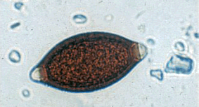 Whipworm Egg