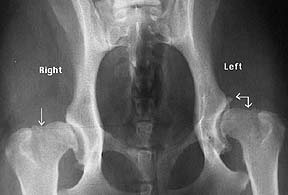 Hip Dysplasia